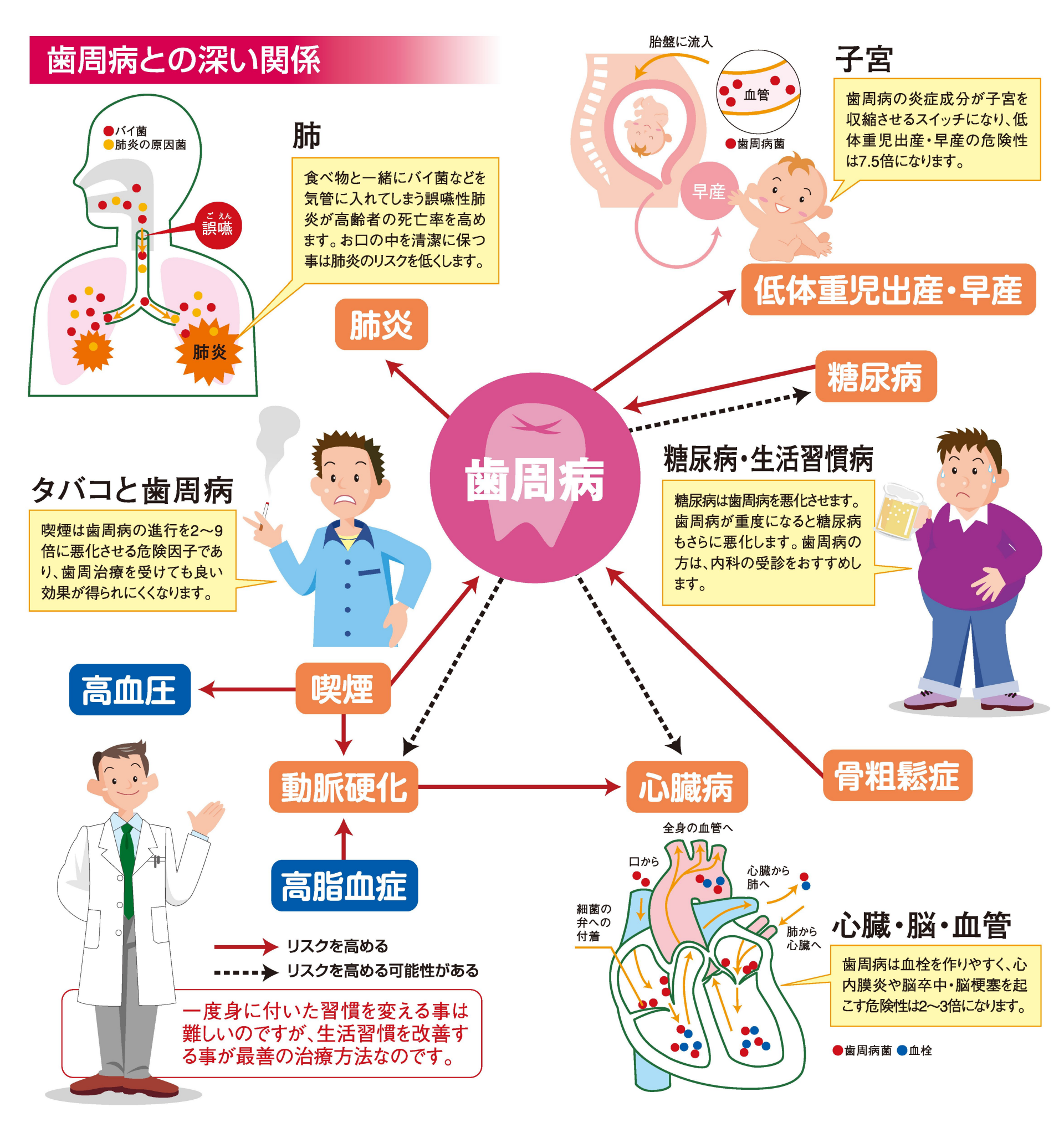 歯周病と全身疾患（心疾患、糖尿病、早産など）